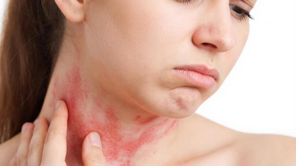 Причины аллергии на алкоголь почему она возникает