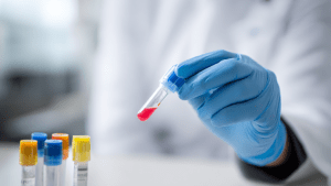 Какие анализы нужны для гастроэнтеролога: список и рекомендации. Зачем сдавать общий и биохимический анализ крови