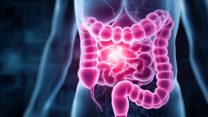 Колоректальный рак: симптомы, диагностика и лечение