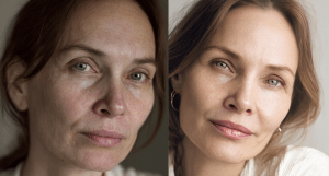 Молодость после 40 лет