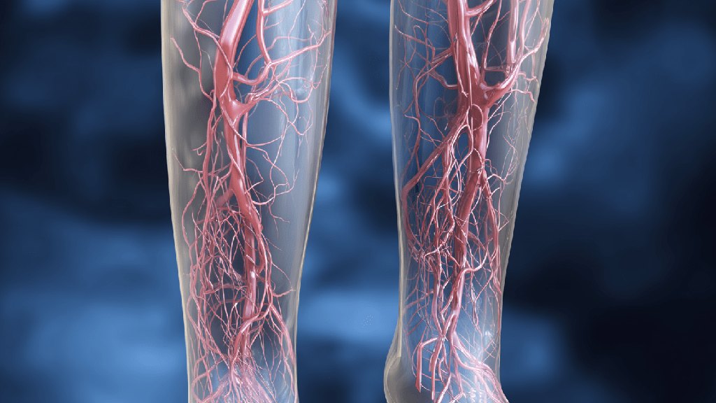 Венозная недостаточность нижних конечностей