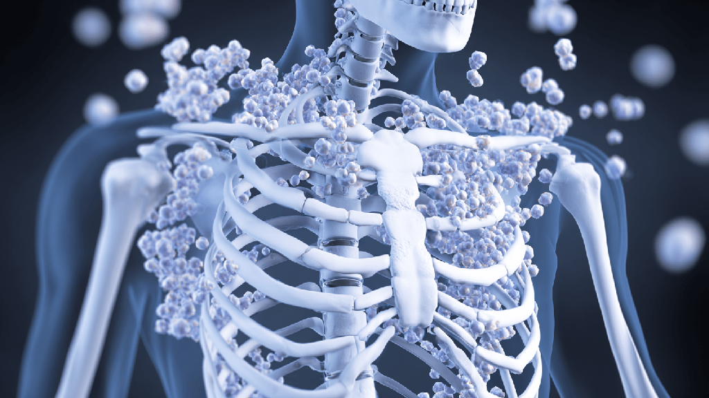 Избыток кальция в организме
