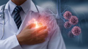 Карциноидный синдром