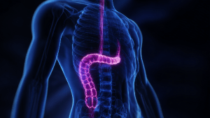 Грыжа пищеводного отверстия диафрагмы