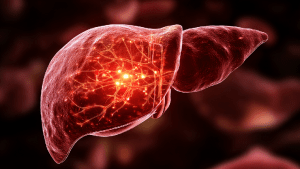 Диета при стеатогепатите печени