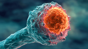 Саркома мягких тканей