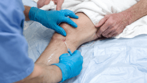 Тромбофлебит лечение