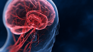 Диета после инсульта