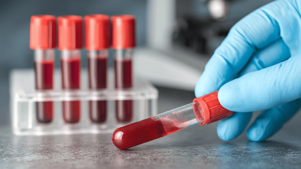 Анализ на гликированный гемоглобин