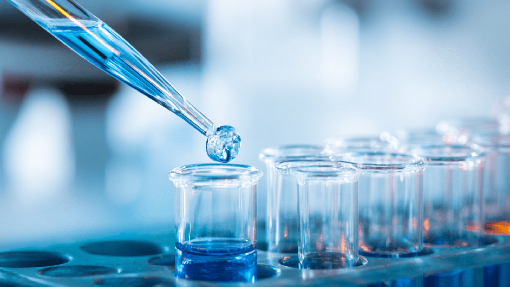 Анализ на гомоцистеин