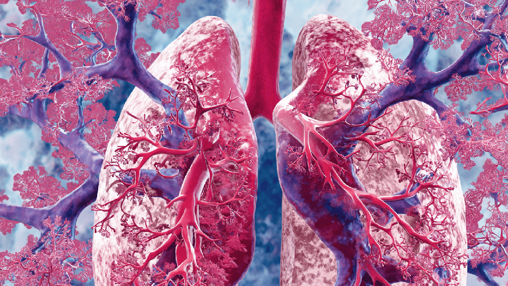 Легочная тромбоэмболия