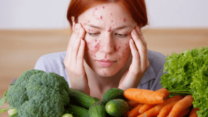 Диета при дерматите