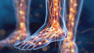 Полинейропатия