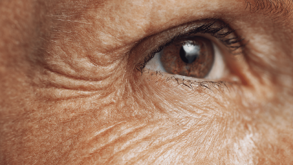 Липофусцин пигмент старения