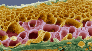 Гиперплазия слизистой желудка