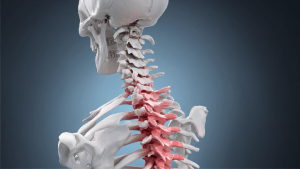 Межпозвоночная протрузия