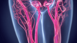 Варикоз малого таза у женщин