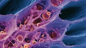 Реактивные изменения эпителия при воспалении