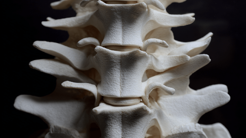 Межпозвоночная протрузия