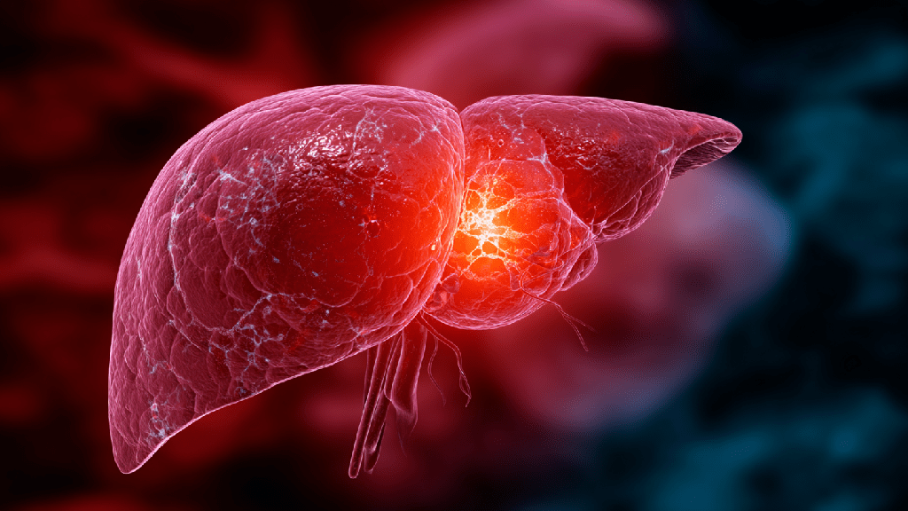 Абсцесс печени