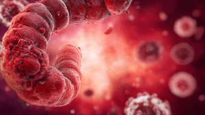 Аллергический энтероколит