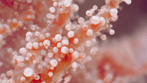 Диета при кандидозе