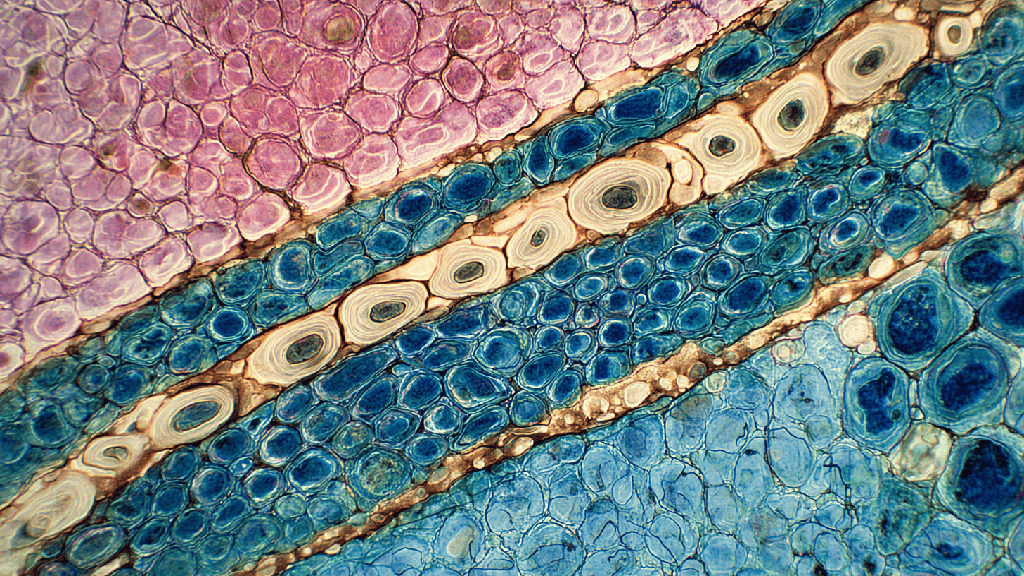 Реактивные изменения эпителия при воспалении 