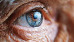 Возрастная макулодистрофия сетчатки