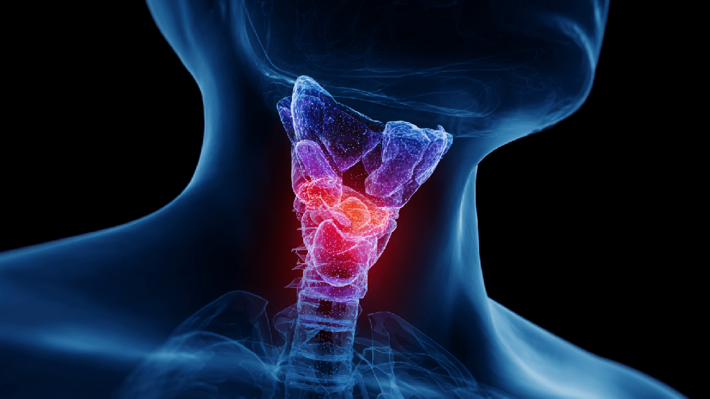 Острый тиреоидит