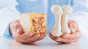 Какие продукты полезны для укрепления костей