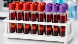 Диета по группе крови как выбрать питание для своей группы