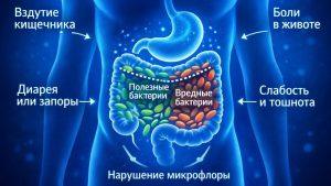 Дисбактериоз кишечника симптомы и эффективное лечение у взрослых