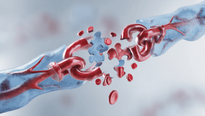 Гемофилия простыми словами: нарушение свертываемости крови