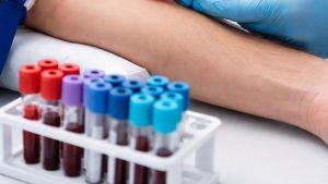 Какие анализы показывают онкологию в организме человека