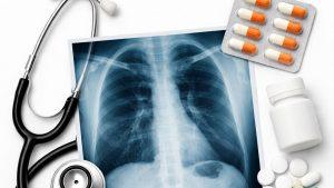 Питание при туберкулёзе