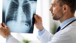 Саркоидоз легких