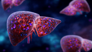 Диффузные изменения печени