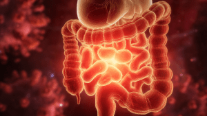 Свищ прямой кишки