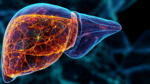 Жировая инфильтрация печени