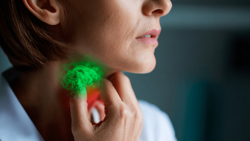 Лимфома: что это за болезнь, симптомы, стадии и лечение