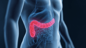 Спазм привратника желудка