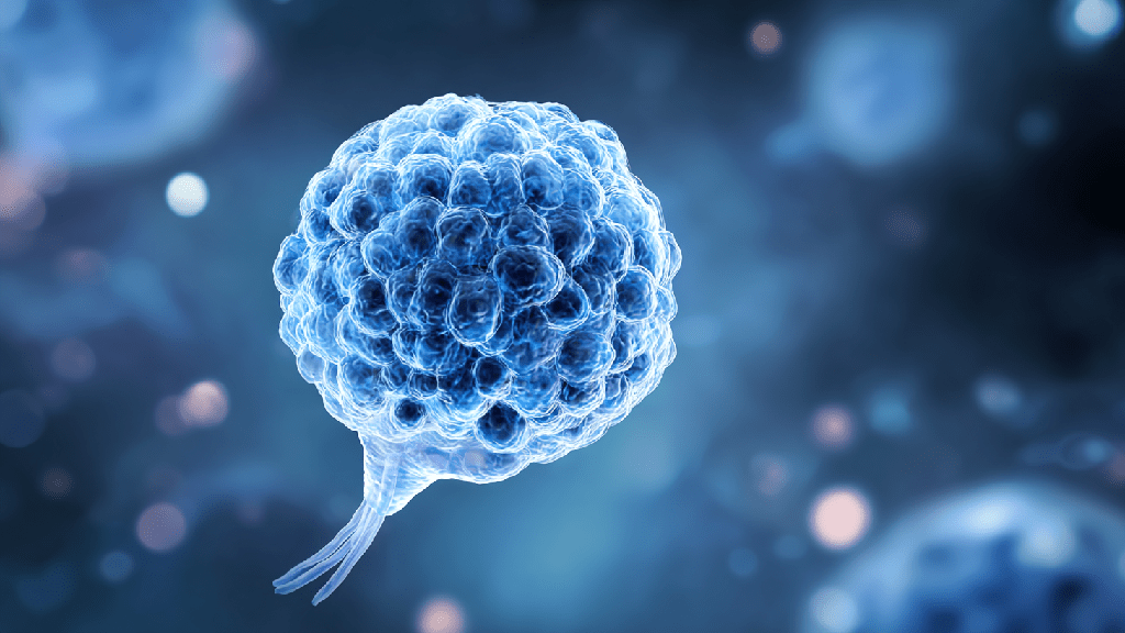 Рак мочевого пузыря: симптомы, признаки и особенности заболевания