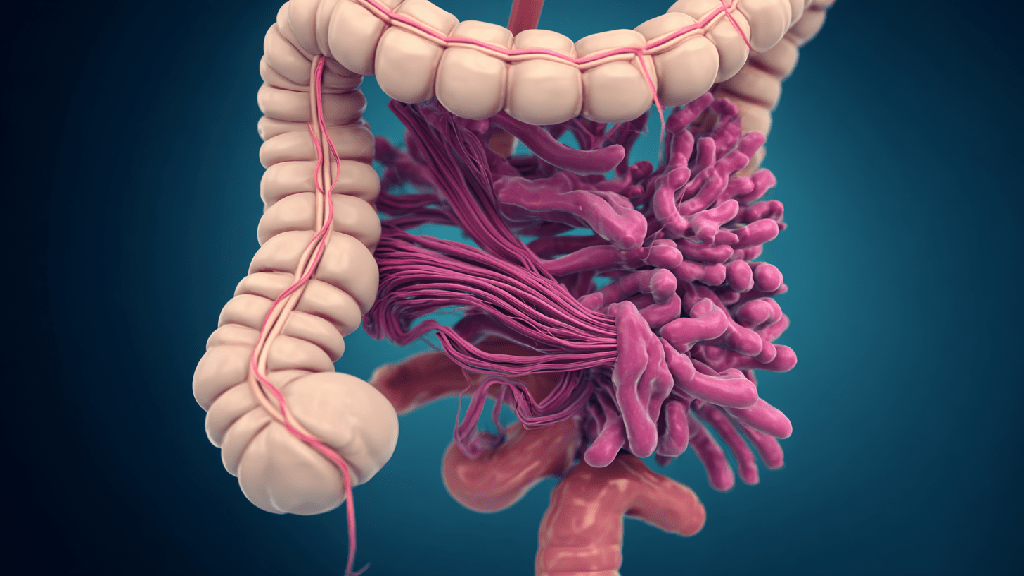 Нарушение моторики кишечника
