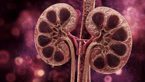 Гидронефроз почки