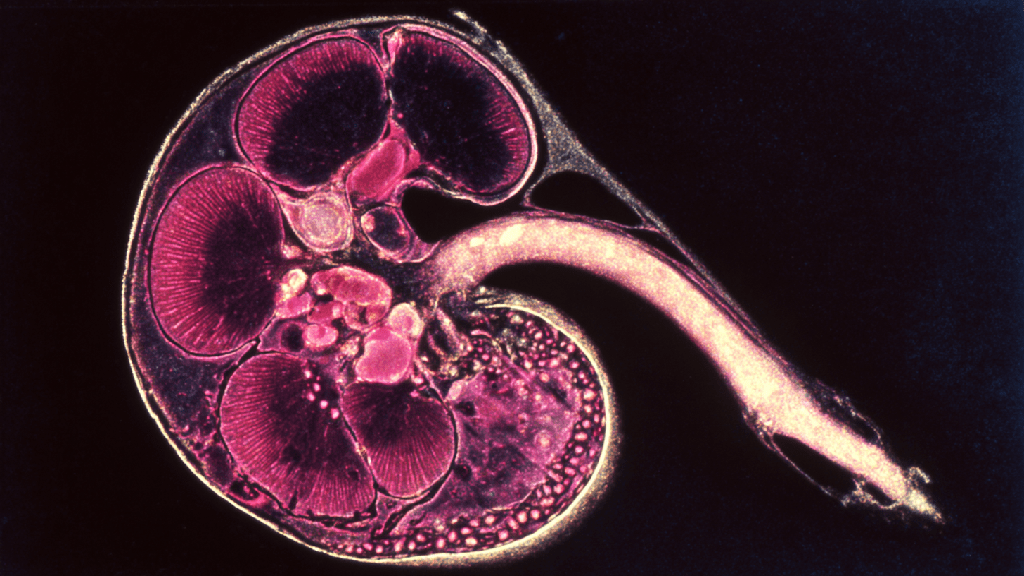 Спленомегалия