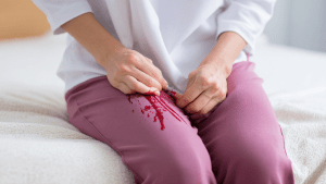 Дисфункциональное маточное кровотечение