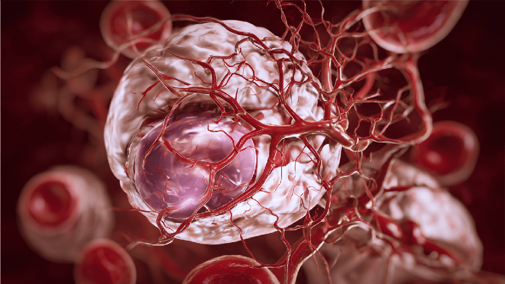 Хроническая ишемия головного мозга
