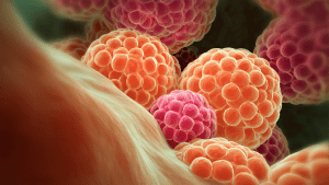 Гиперплазия эндометрия