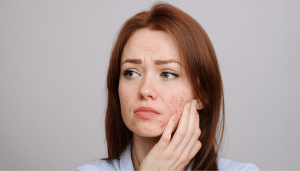 Питание при псориазе: как противовоспалительная диета помогает коже