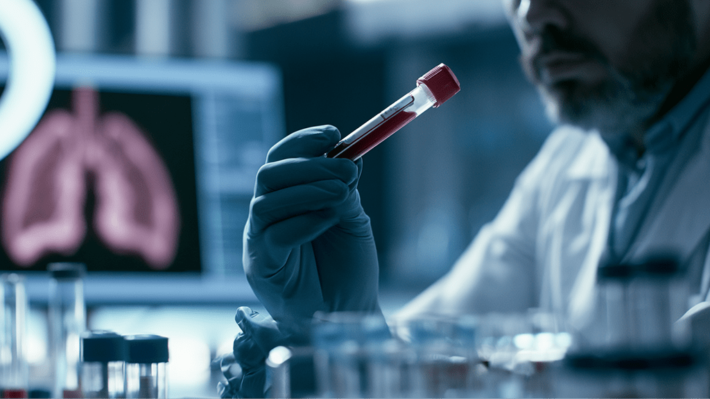T-SPOT.TB и нутрициология: почему длительную слабость и снижение веса не стоит списывать только на дефициты